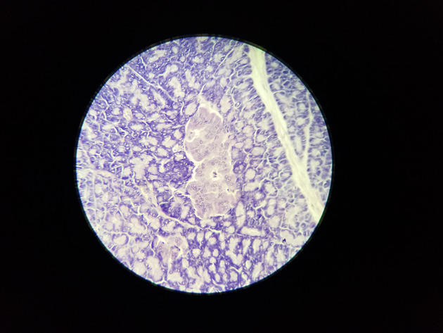 Pancreas Slides - Pancreas 007 100X